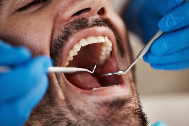 Best Urgent Tooth Repair  in Martin, SD