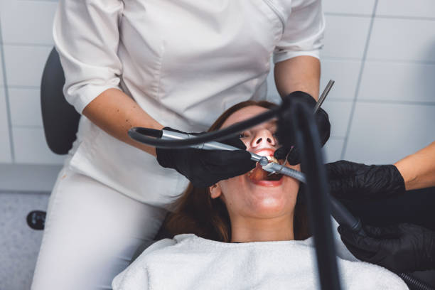 Emergency Dental Filling Replacement in SD